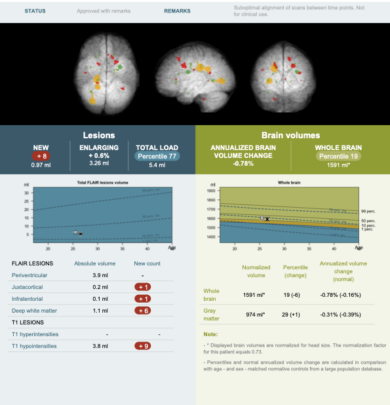 icobrain