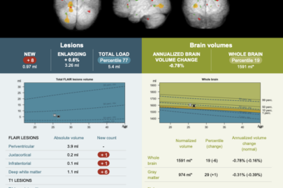 icobrain