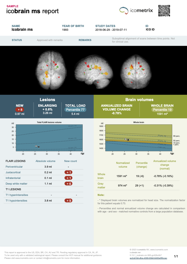 icobrain